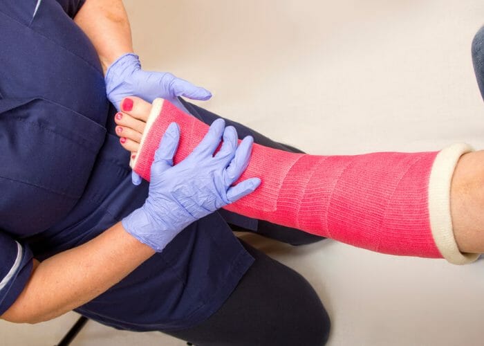 a nurse holding up a woman's leg in a red cast