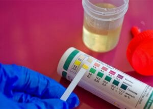 Woman using urine ketosis strips to test her ketone levels